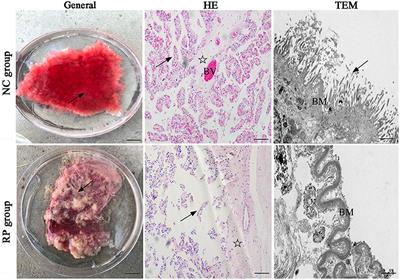 miRNA-150_R-1 mediates the HIF-1/ErbB signaling pathway to regulate the adhesion of endometrial epithelial cells in cows experiencing retained placenta